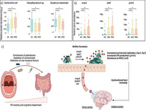 Vi khuẩn miệng và ruột có liên quan đến những thay đổi ở não trong bệnh Parkinson
