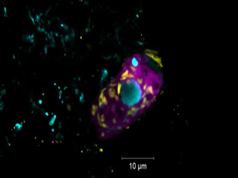 Vi khuẩn cộng sinh góp phần làm sạch nước thải