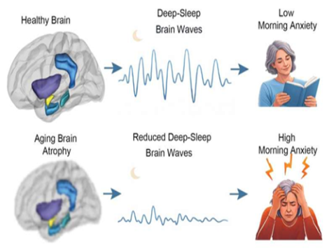 Ngủ ngon hơn có thể giúp giảm lo âu ở tuổi già