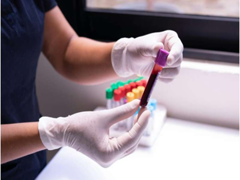 Phát hiện nhiều loại ung thư và các bệnh khác từ một mẫu máu duy nhất