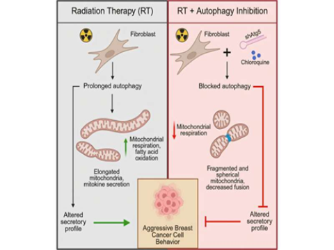 Xạ trị có thể gây ra những thay đổi mô, tạo điều kiện cho ung thư vú ba thể âm tính tái phát