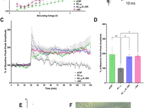 Chiến lược điều trị tiềm năng cho bệnh Alzheimer giúp cải thiện hiệu quả học tập và ghi nhớ